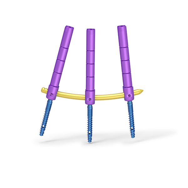 Fabricante Sistema de columna de columna de columna de implantes ortopédicos con CE con CE